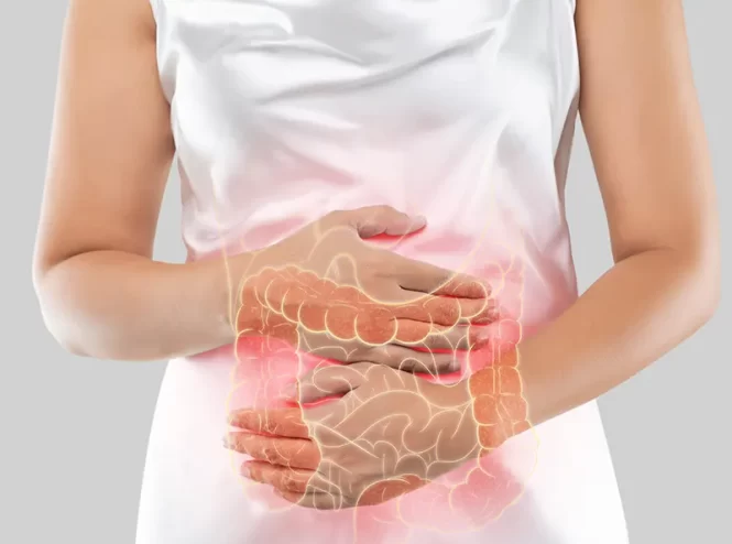 بیماری التهابی روده IBD
