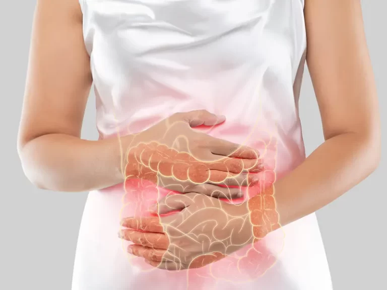 بیماری التهابی روده