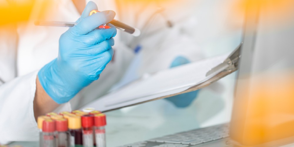 آمینو اسید ها