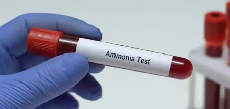 آمونیاک