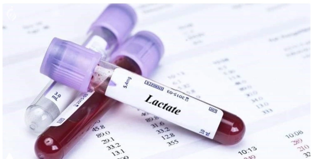 آزمایش لاکتات