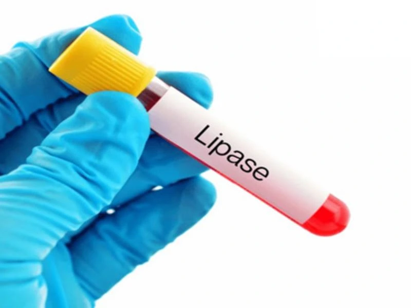 آزمایش لیپاز