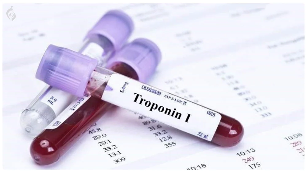 Troponin