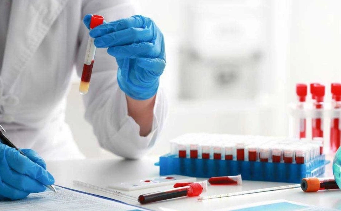 گالاکتوزمی