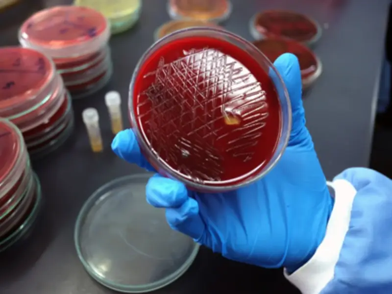 آزمایش Blood Culture