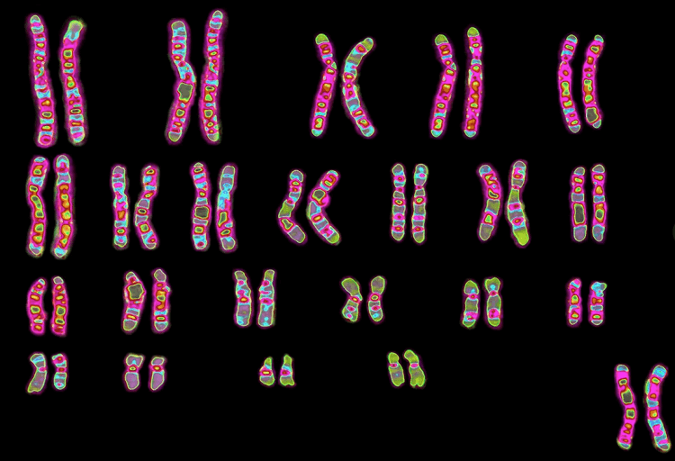 کاریوتایپ خون